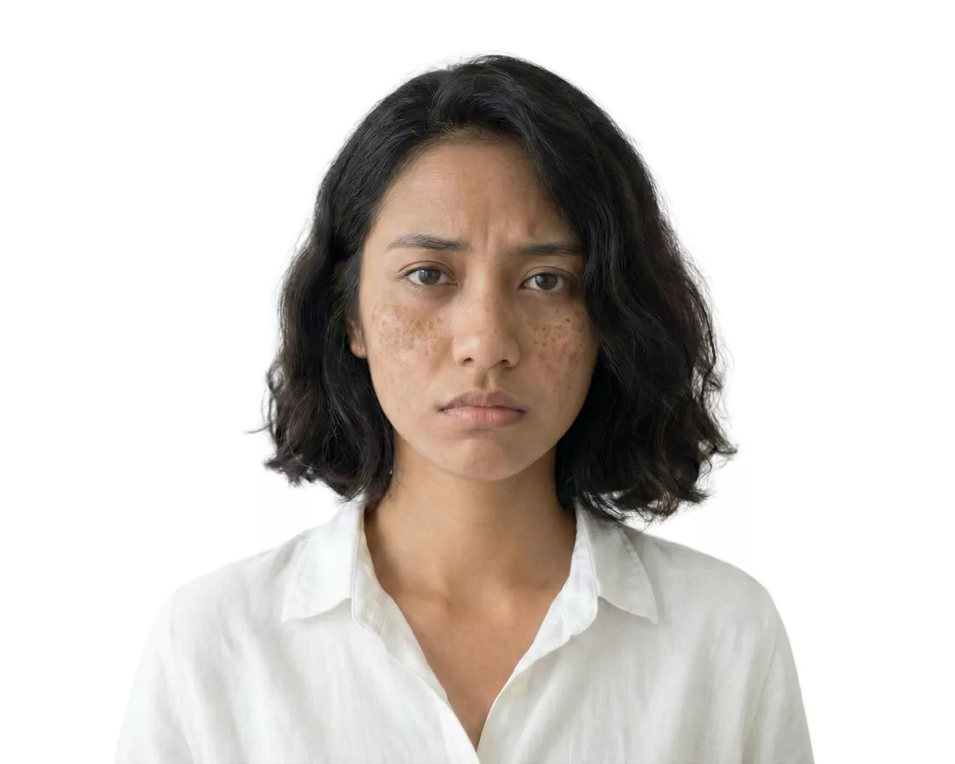 Testimoni before penggunaan Brifa Skincare